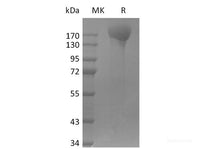 Recombinant SARS-CoV-2 ΔFVI-S trimer Protein(His Tag)