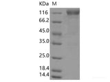 Recombinant SARS-CoV-2 Spike S1(D614G),ECD(Fc Tag)