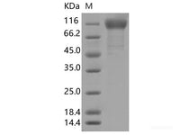 Recombinant SARS-CoV-2 Spike S1 (Q677H)(His Tag)