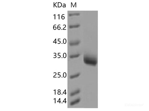 Recombinant SARS-CoV-2 Spike RBD(Y508H)(His Tag)