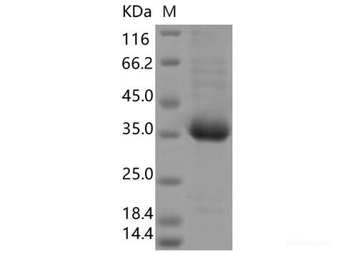 Recombinant SARS-CoV-2 Spike RBD(V503F)(His Tag)