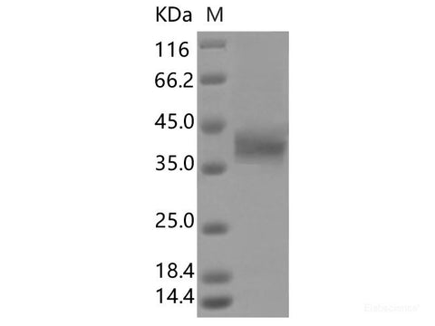 Recombinant SARS-CoV-2 Spike RBD(A372S)(His Tag)