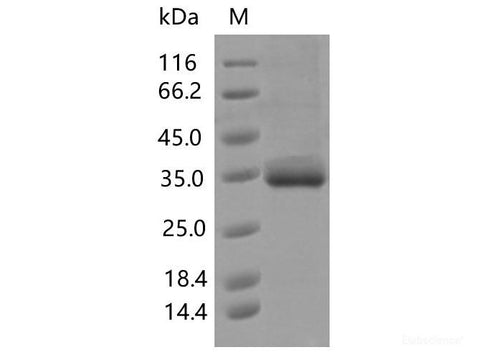 Recombinant SARS-CoV-2 Spike RBD(V483I)(His Tag)