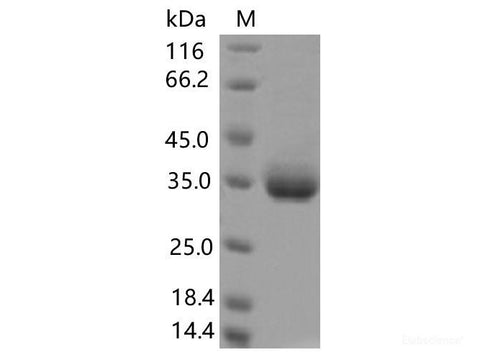 Recombinant SARS-CoV-2 Spike RBD(S359N)(His Tag)