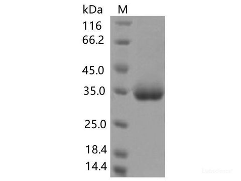 Recombinant SARS-CoV-2 Spike RBD(K378R)(His Tag)