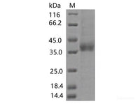 Recombinant SARS-CoV-2 Spike RBD(A372T)(His Tag)