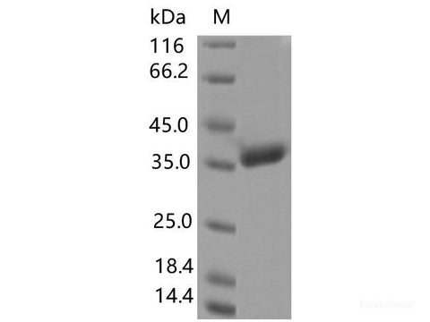 Recombinant SARS-CoV-2 Spike RBD(A344S)(His Tag)