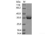 Recombinant SARS-CoV-2 Spike RBD(A520V)(His Tag)