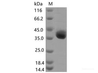 Recombinant SARS-CoV-2 Spike RBD(E406Q)(His Tag)