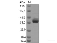 Recombinant SARS-CoV-2 Spike RBD(F490S)(His Tag)