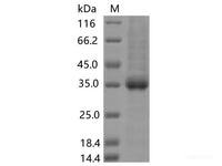 Recombinant SARS-CoV-2 Spike RBD(N370S)(His Tag)