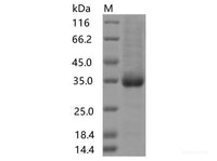 Recombinant SARS-CoV-2 Spike RBD(S477I)(His Tag)