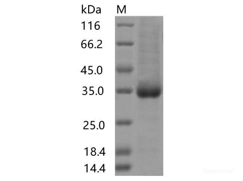 Recombinant SARS-CoV-2 Spike RBD(S477I)(His Tag)