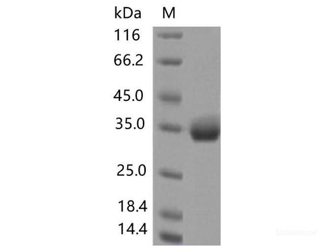 Recombinant SARS-CoV-2 Spike RBD(S477N)(His Tag)