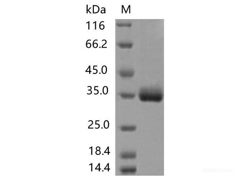 Recombinant SARS-CoV-2 Spike RBD(T393P)(His Tag)