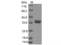 Recombinant SARS-CoV-2 Spike RBD(V395I)(His Tag)