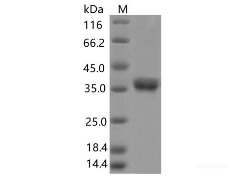 Recombinant SARS-CoV-2 Spike RBD(V395I)(His Tag)