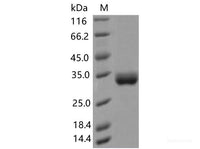 Recombinant SARS-CoV-2 Spike RBD(A475V)(His Tag)