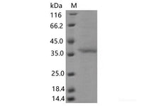 Recombinant SARS-CoV-2 Spike RBD(G446V)(His Tag)