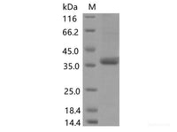 Recombinant SARS-CoV-2 Spike RBD(G482S)(His Tag)