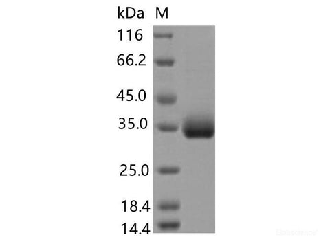 Recombinant SARS-CoV-2 Spike RBD(E471Q)(His Tag)