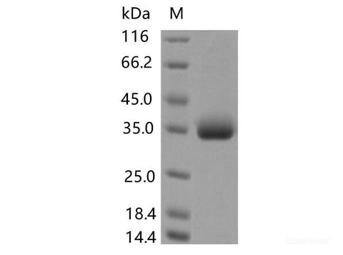 Recombinant SARS-CoV-2 Spike RBD(P479S)(His Tag)