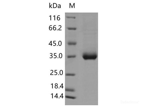 Recombinant SARS-CoV-2 Spike RBD(L455F)(His Tag)