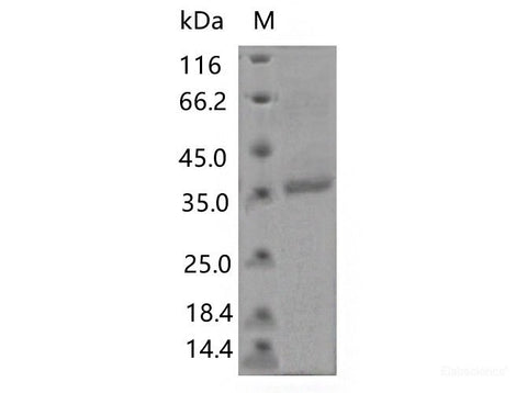 Recombinant SARS-CoV-2 Spike RBD(K458Q)(His Tag)