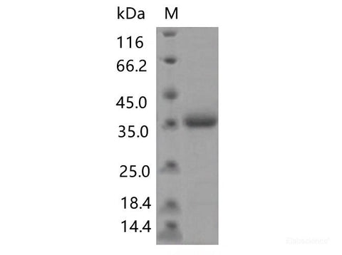 Recombinant SARS-CoV-2 Spike RBD(N481D)(His Tag)