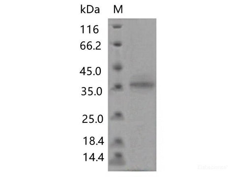 Recombinant SARS-CoV-2 Spike RBD(F456L)(His Tag)