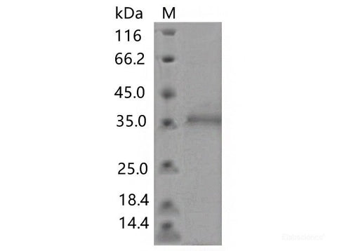 Recombinant SARS-CoV-2 Spike RBD(Y505C)(His Tag)