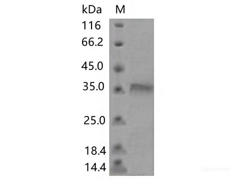 Recombinant SARS-CoV-2 Spike RBD(F456E)(His Tag)