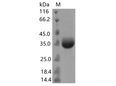 Recombinant SARS-CoV-2 Spike RBD(G446S)(His Tag)