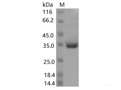 Recombinant SARS-CoV-2 Spike RBD(P499R)(His Tag)