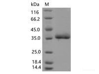 Recombinant SARS-CoV-2 Spike RBD(F490L)(His Tag)