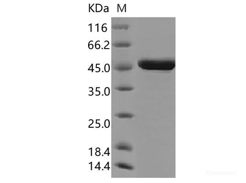 Recombinant SARS-CoV-2 Nucleocapsid Protein (N-His Tag)(Omicron)