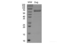 Recombinant SARS-CoV-2 Spike RBD Protein (C-hFc Tag)(Omicron)