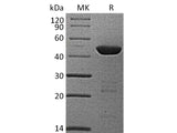 Recombinant Human HPD/4HPPD Protein (His Tag)