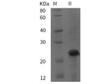 Recombinant Rat GPRC6A protein (His tag)