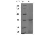 Recombinant Rat ADP protein (His tag)