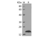 Recombinant Human CDNF/ARMETL1 Protein (His Tag)