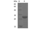 Recombinant Porcine IL-6 protein (His tag)