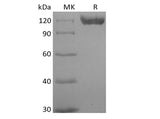 Recombinant Human B-cell Receptor CD22/Siglec-2/CD22 (C-6His) Biotinylated