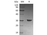 Recombinant Human Syntaxin-6/STX6 Protein
