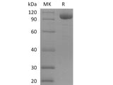 Recombinant Human Leukocyte Ig-Like Receptor B2/LILRB2/ILT4/CD85d (C-Fc