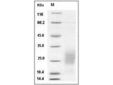 Recombinant Human GM-CSF Protein (HEK293 Cells) (His Tag)(Active)