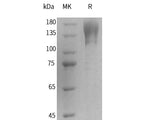 Recombinant Human T-cell Surface Protein Tactile/CD96(C-Fc) 